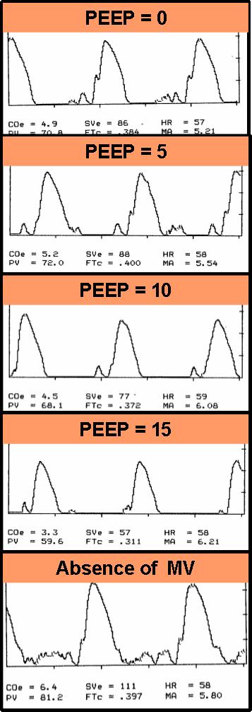 Figure 1. Period A: ODM Waveforms (traces)